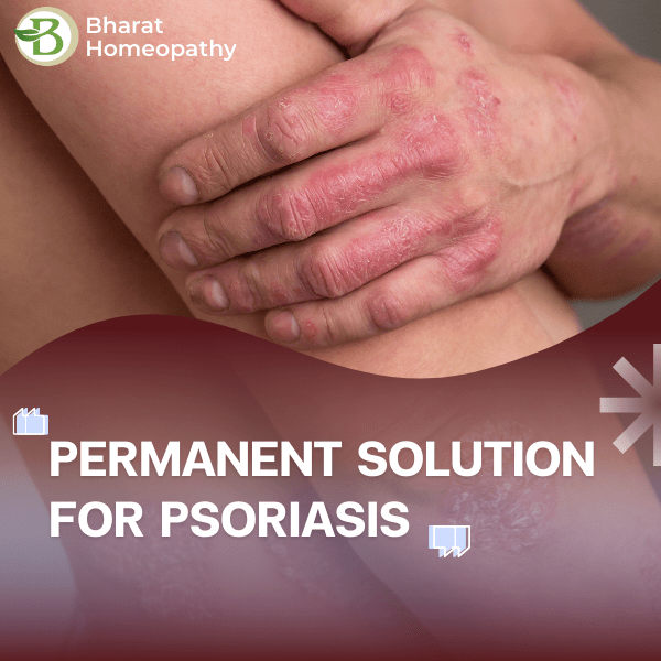 permanent solution for psoriasis