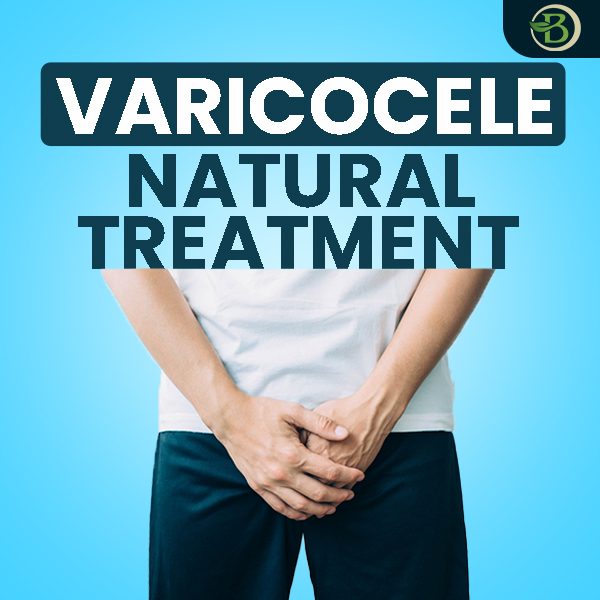 best varicocele treatment